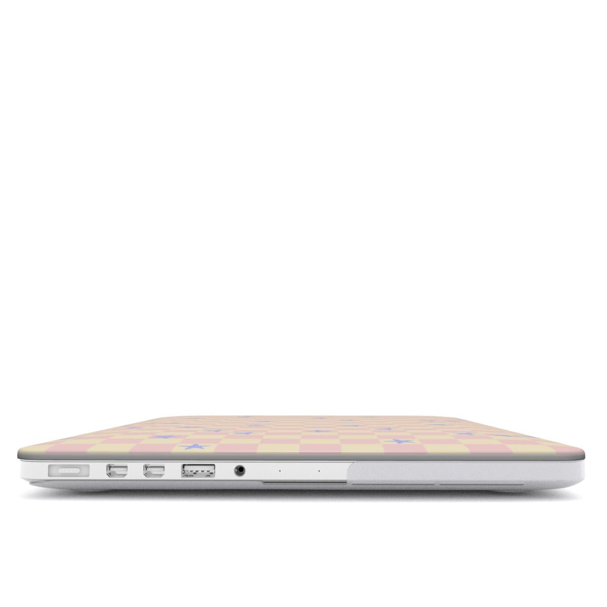 STARSTRUCK - Protective Apple Macbook Case | QUAVVICASES